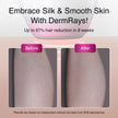 DermRays V6S Laser Hair Removal, 1064nm, Specifically For Deep Skin