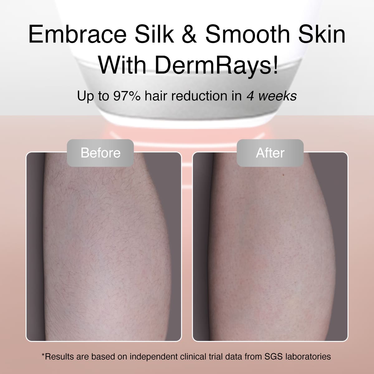DermRays V8S Laser Hair Removal, Up to 27J, Faster Results, Most Powerful