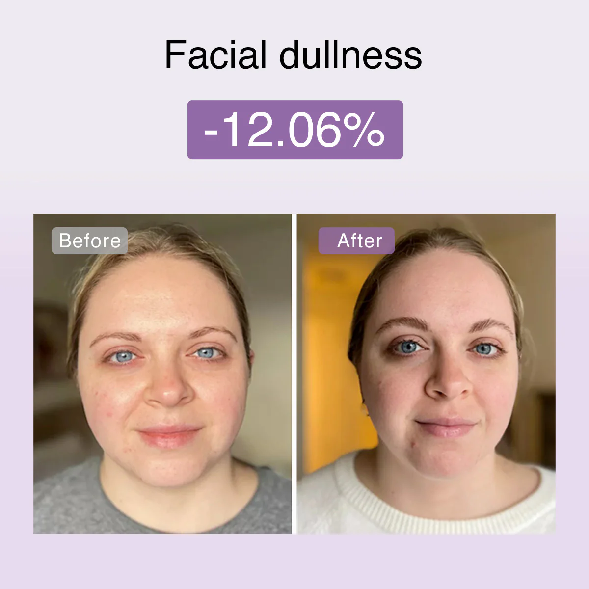 DermRays FusionGlow Multi-Functional Microcurrent Facial Toning Device - Image 6