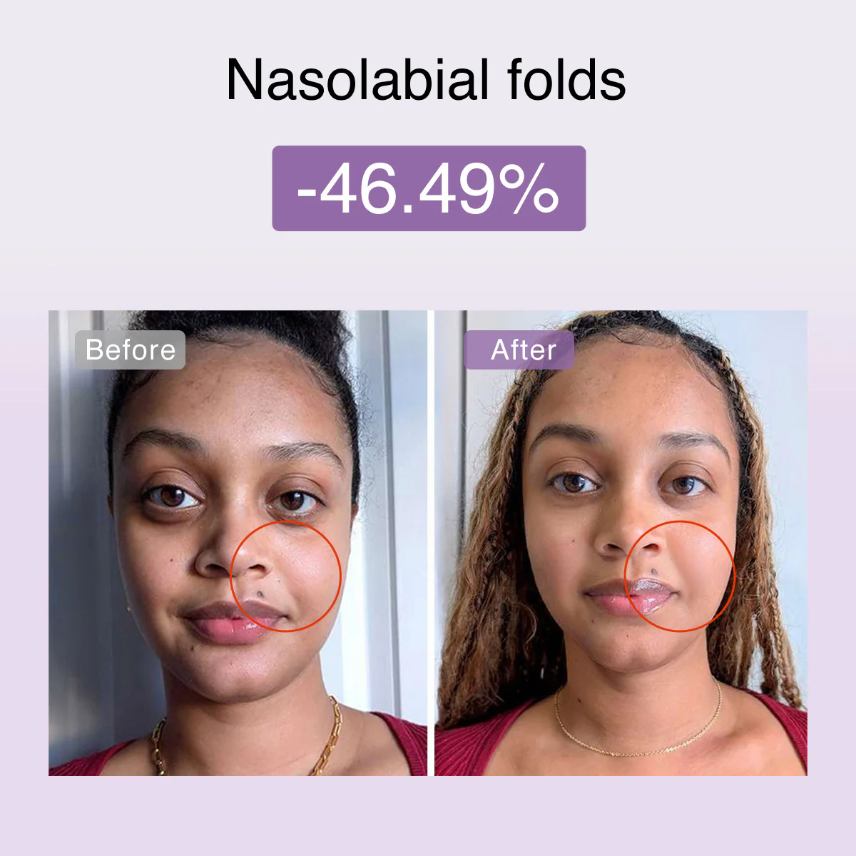 DermRays FusionGlow Multi-Functional Microcurrent Facial Toning Device - Image 7