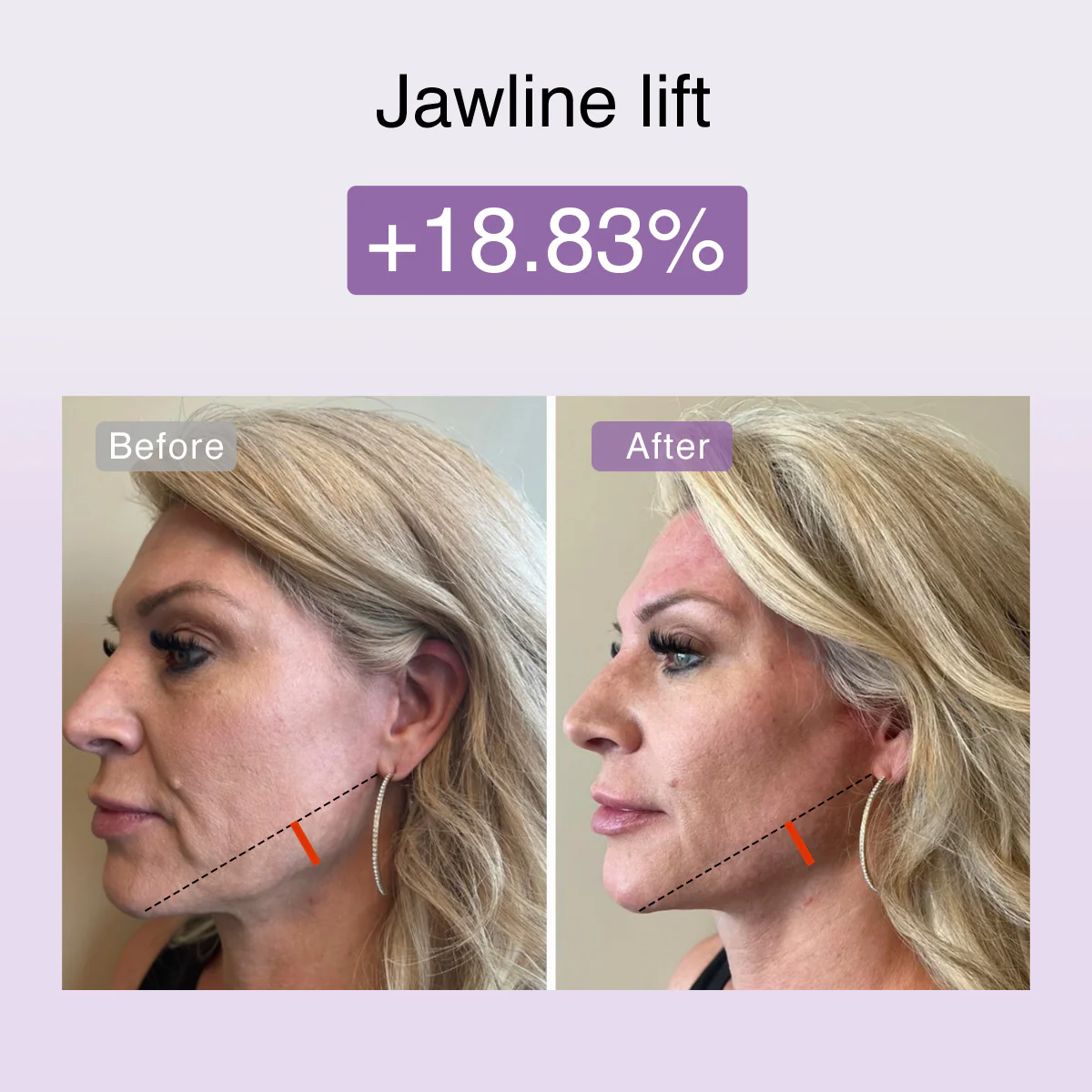 DermRays FusionGlow Multi-Functional Microcurrent Facial Toning Device - Image 8